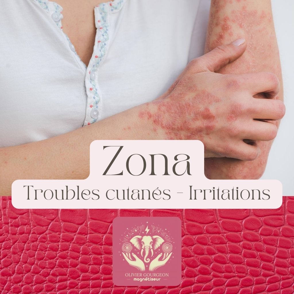 Irritations de la peau